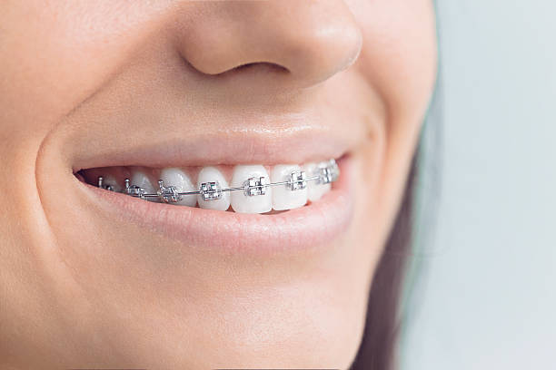 Best Dental Fillings (Composite and Amalgam)  in Selma, CA